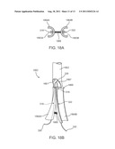 Apparatus and Methods for Creating a Venous Valve from Autologous Tissue diagram and image