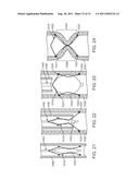 Apparatus and Methods for Creating a Venous Valve from Autologous Tissue diagram and image