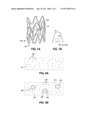 Polymer-Bioceramic Composite Implantable Medical Device with Different     Types of Bioceramic Particles diagram and image