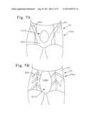 Absorbent Articles Comprising Graphics diagram and image