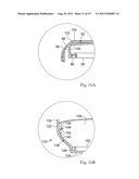 CONTAINER SYSTEMS WITH LIDS FOR UNIT DOSE DETERGENT COMPOSITIONS diagram and image