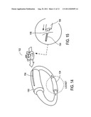 IDENTIFICATION BAND diagram and image