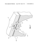 FLUID EJECTOR STRUCTURE diagram and image