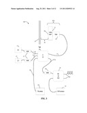 COMPACT FIBER OPTIC GEOMETRY FOR A COUNTER CHIRP FMCW COHERENT LASER RADAR diagram and image