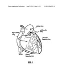 Imaging system and methods for cardiac analysis diagram and image