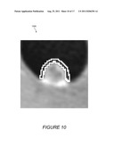 SYSTEMS, COMPUTER-READABLE MEDIA, AND METHODS FOR THE CLASSIFICATION OF     ANOMALIES IN VIRTUAL COLONOGRAPHY MEDICAL IMAGE PROCESSING diagram and image