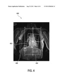 AUTOMATED SEQUENTIAL PLANNING OF MR SCANS diagram and image