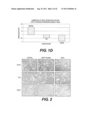 TARGETING PAX2 FOR THE TREATMENT OF BREAST CANCER diagram and image