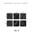 TARGETING PAX2 FOR THE TREATMENT OF BREAST CANCER diagram and image