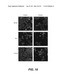 TARGETING PAX2 FOR THE TREATMENT OF BREAST CANCER diagram and image