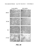 TARGETING PAX2 FOR THE TREATMENT OF BREAST CANCER diagram and image