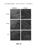 TARGETING PAX2 FOR THE TREATMENT OF BREAST CANCER diagram and image