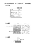 Molecular Determinants Associated With Prostate Cancer And Methods Of Use     Thereof diagram and image