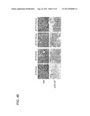 Molecular Determinants Associated With Prostate Cancer And Methods Of Use     Thereof diagram and image
