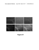 CELL-BASED SCREEN FOR AGENTS USEFUL FOR REDUCING NEURONAL DEMYELINATION OR     PROMOTING NEURONAL REMYELINATION diagram and image