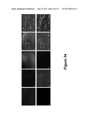 CELL-BASED SCREEN FOR AGENTS USEFUL FOR REDUCING NEURONAL DEMYELINATION OR     PROMOTING NEURONAL REMYELINATION diagram and image