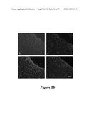 CELL-BASED SCREEN FOR AGENTS USEFUL FOR REDUCING NEURONAL DEMYELINATION OR     PROMOTING NEURONAL REMYELINATION diagram and image