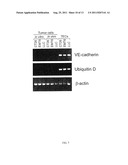 DIFFERENTIAL GENE EXPRESSION IN PHYSIOLOGICAL AND PATHOLOGICAL     ANGIOGENESIS diagram and image