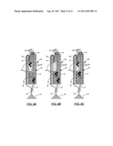 Controlling Powder Delivery Rate in Air Abrasive Instruments diagram and image