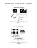 EX VIVO THERAPEUTICS SCREENING OF LIVING BONE MARROW CELLS FOR MULTIPLE     MYELOMA diagram and image