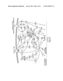 EX VIVO THERAPEUTICS SCREENING OF LIVING BONE MARROW CELLS FOR MULTIPLE     MYELOMA diagram and image