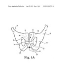 IMPLANTABLE URETHRAL PROSTHESIS HAVING TABLE MEMBER diagram and image