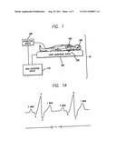 System and method of aquiring blood-vessel data diagram and image