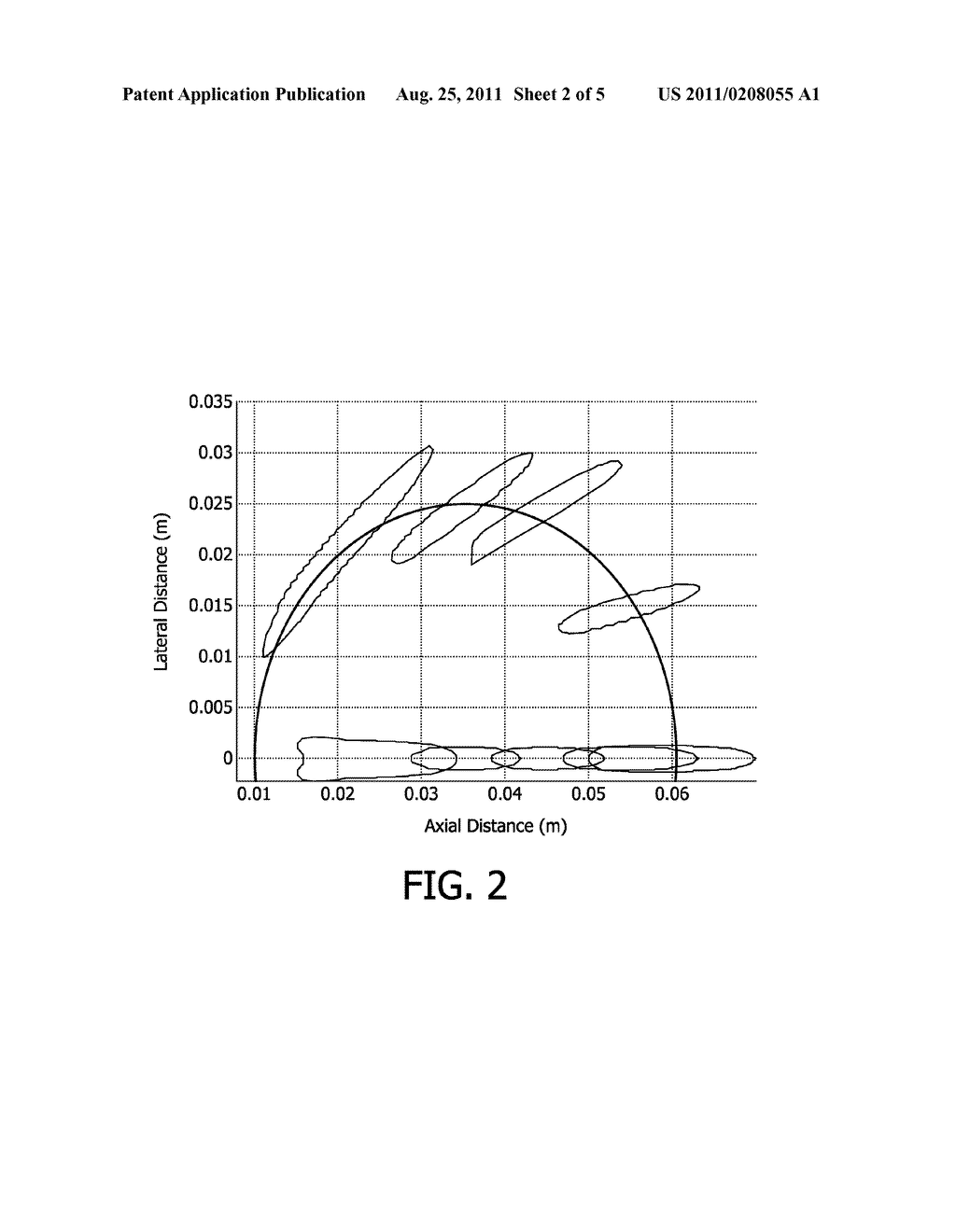 METHOD AND SYSTEM FOR ULTRASOUND THERAPY - diagram, schematic, and image 03