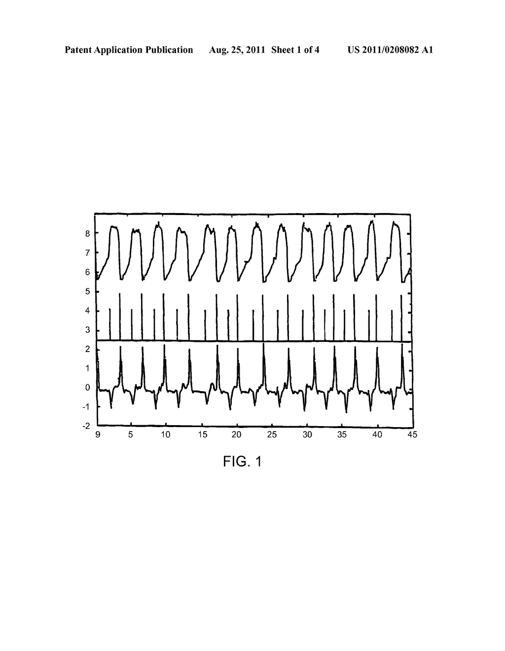 Method and apparatus for detecting the respiratory activity of a person - diagram, schematic, and image 02