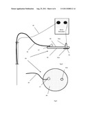 MEDICAL DEVICE FOR INJECTING LOCAL ANESTHETIC diagram and image
