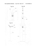 System with a reservoir for perfusion management diagram and image