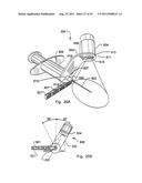 Micro vein enhancer diagram and image