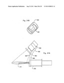 Micro vein enhancer diagram and image