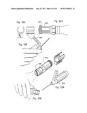 Micro vein enhancer diagram and image