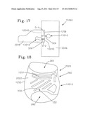 Absorbent Articles Comprising Graphics diagram and image