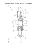 Safety Drug Delivery System diagram and image