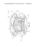 Pressure Sensing in Implantable Medical Devices diagram and image