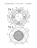 INTRAMEDULLARY DEVICE AND METHOD OF USE diagram and image