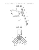 CROSSOVER SPINOUS PROCESS IMPLANT diagram and image