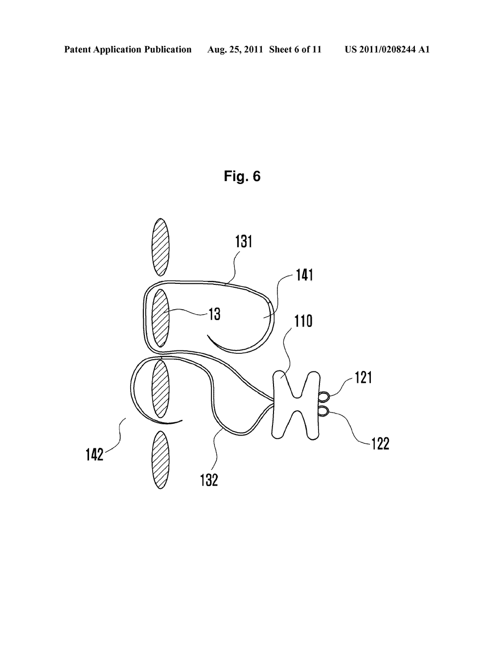 INTERSPINOUS SUPPORT AND METHOD FOR FIXING SAME - diagram, schematic, and image 07