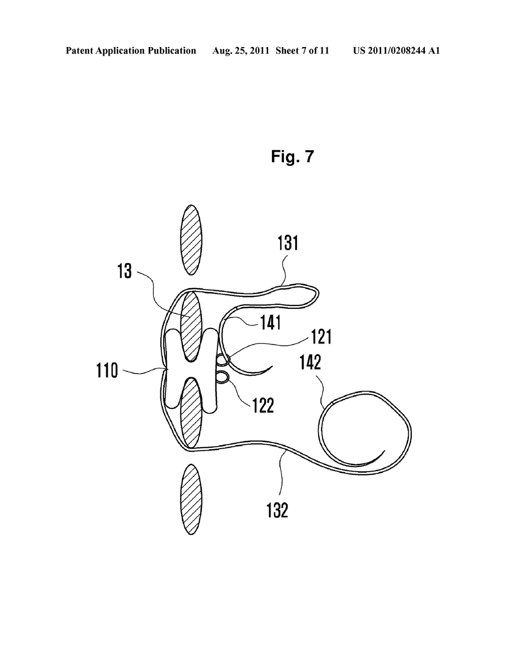 INTERSPINOUS SUPPORT AND METHOD FOR FIXING SAME - diagram, schematic, and image 08