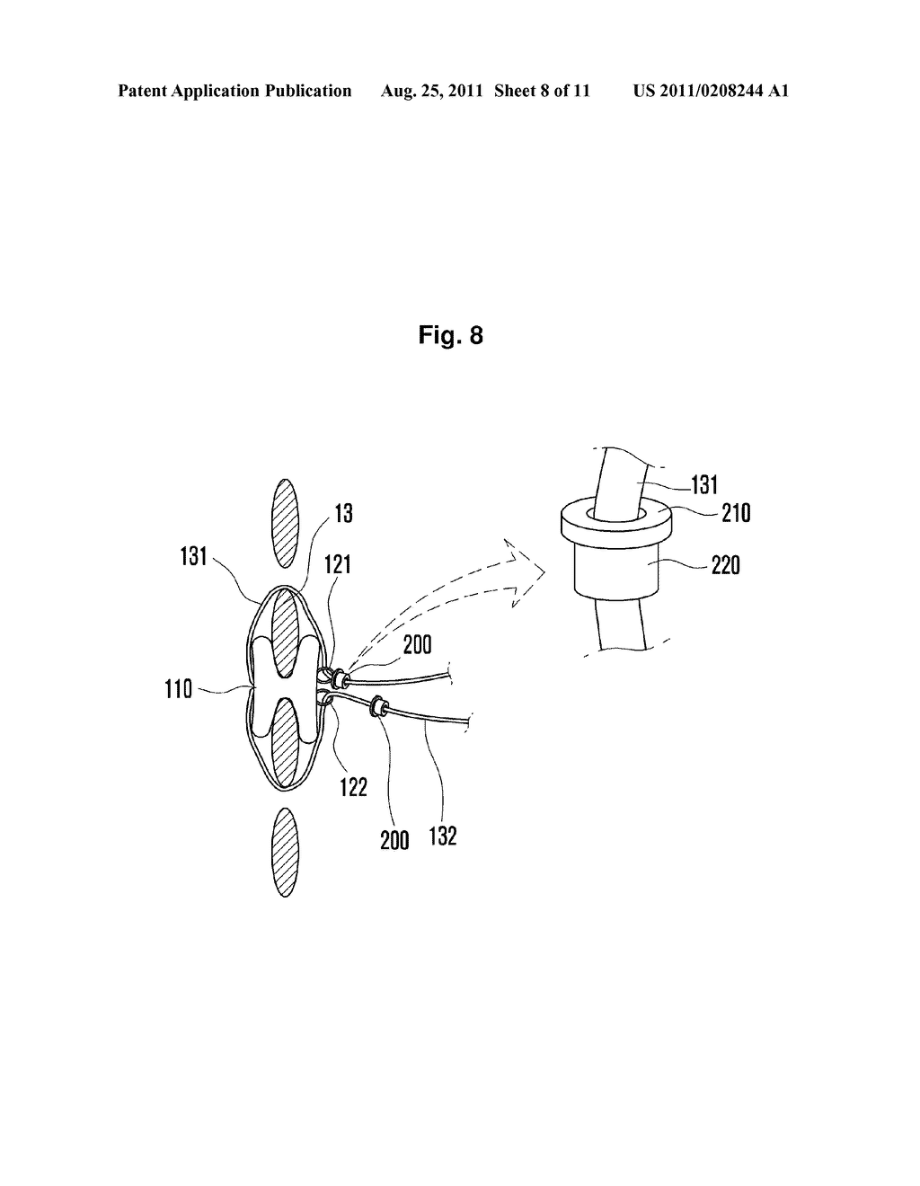 INTERSPINOUS SUPPORT AND METHOD FOR FIXING SAME - diagram, schematic, and image 09