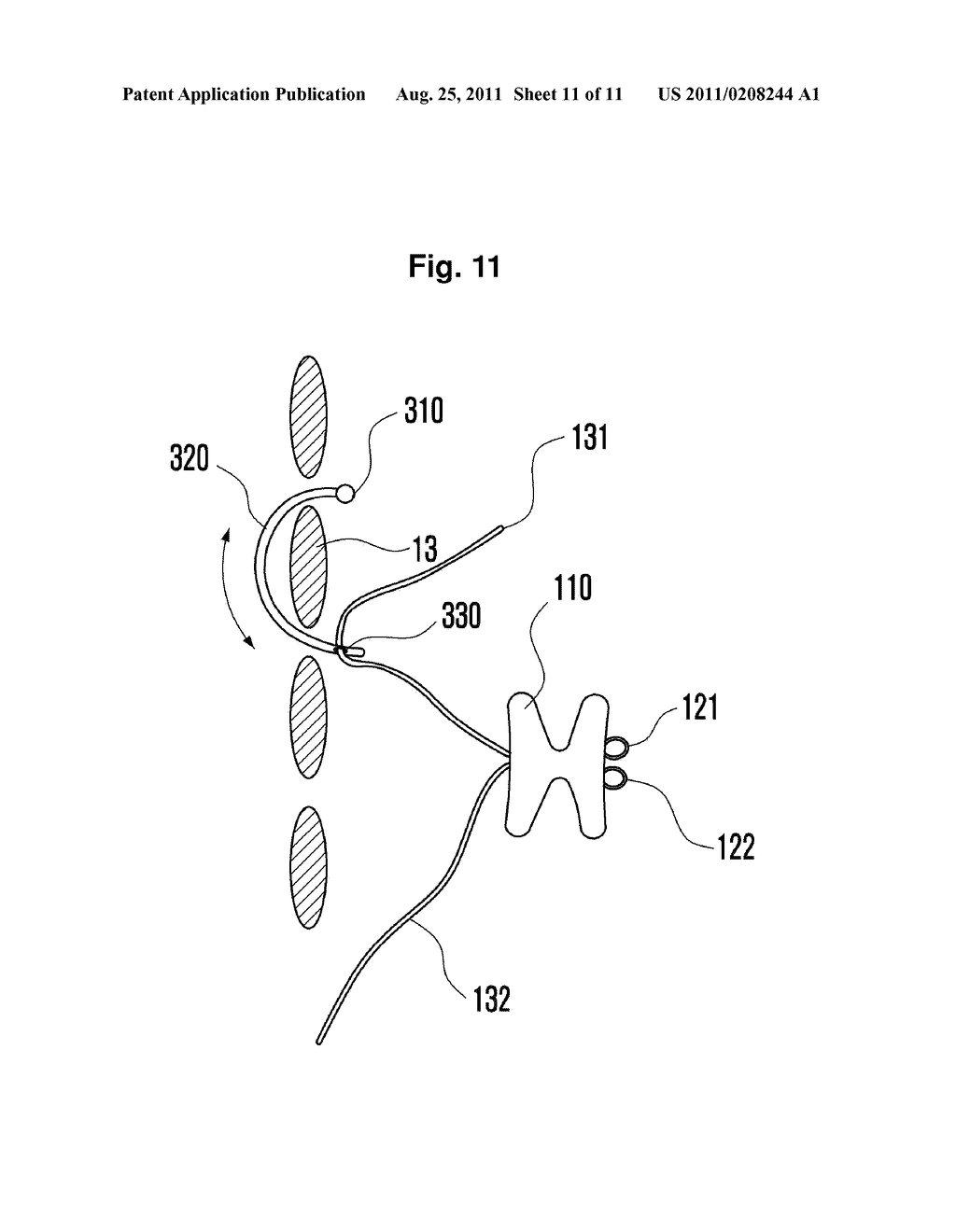 INTERSPINOUS SUPPORT AND METHOD FOR FIXING SAME - diagram, schematic, and image 12