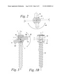 ADJUSTABLE BONE SCREW ASSEMBLY diagram and image