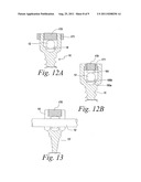 ADJUSTABLE BONE SCREW ASSEMBLY diagram and image