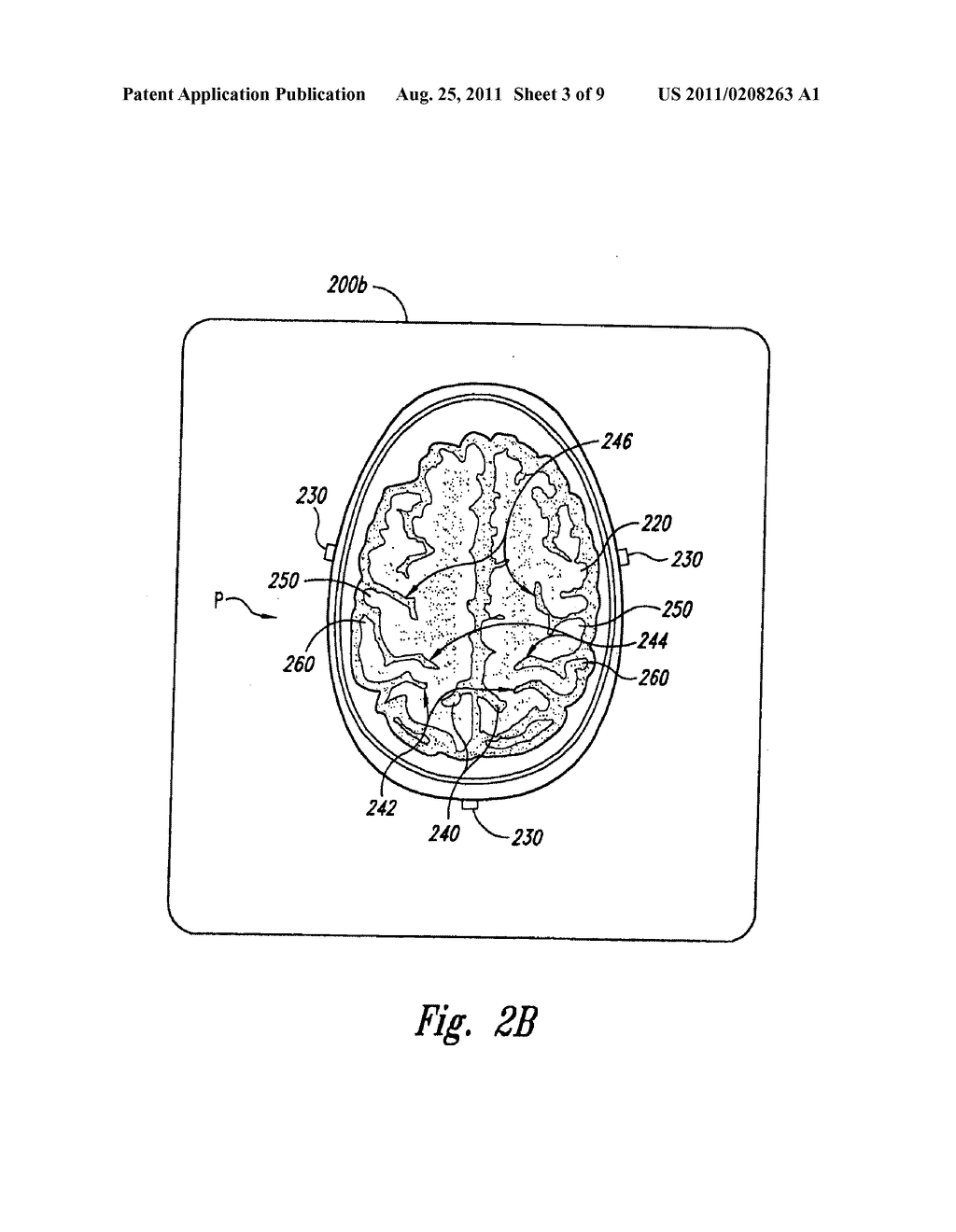 SYSTEM AND METHOD FOR TREATING PARKINSON'S DISEASE AND OTHER MOVEMENT     DISORDERS - diagram, schematic, and image 04