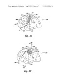 SYSTEM AND METHOD FOR TREATING PARKINSON S DISEASE AND OTHER MOVEMENT     DISORDERS diagram and image