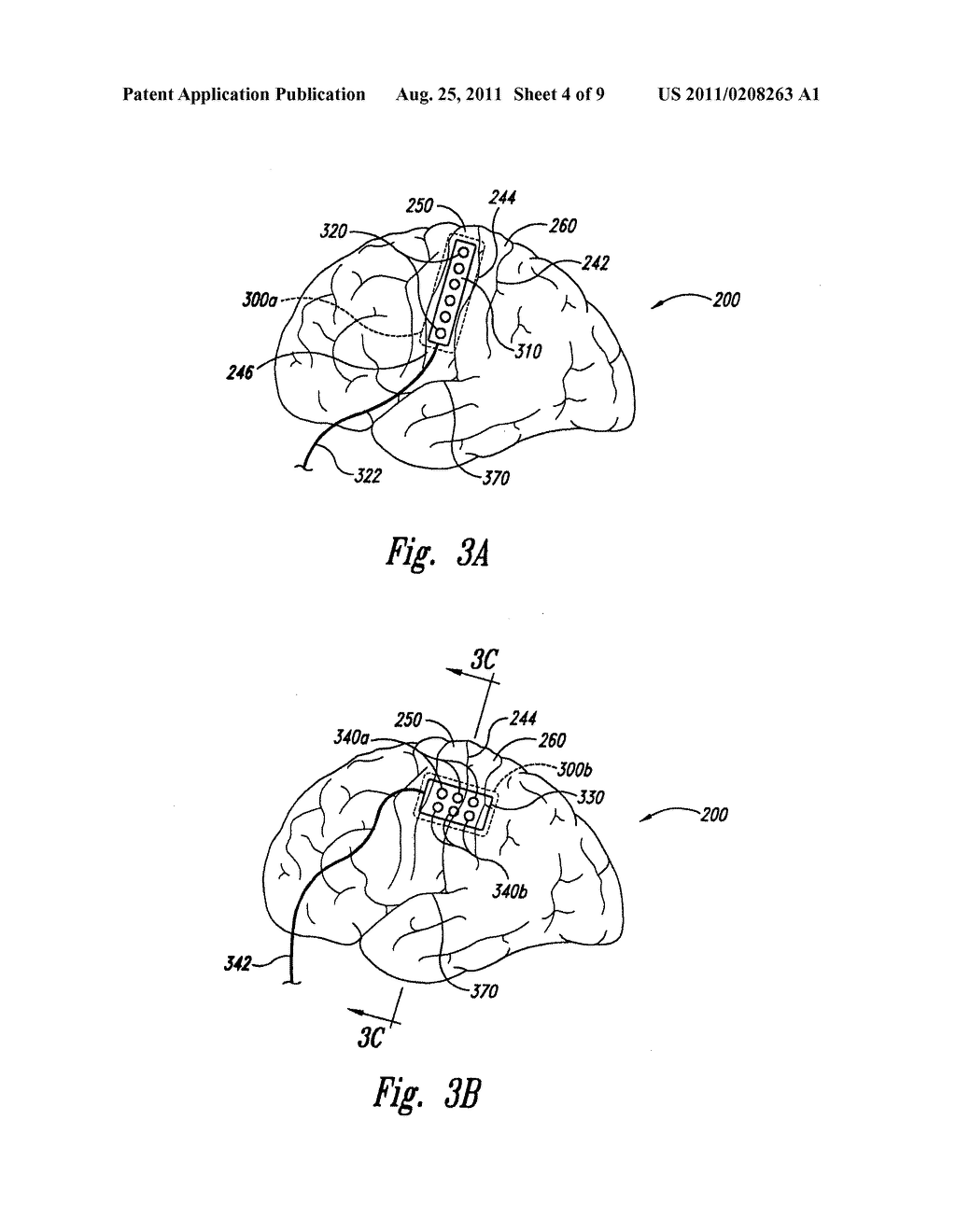 SYSTEM AND METHOD FOR TREATING PARKINSON'S DISEASE AND OTHER MOVEMENT     DISORDERS - diagram, schematic, and image 05