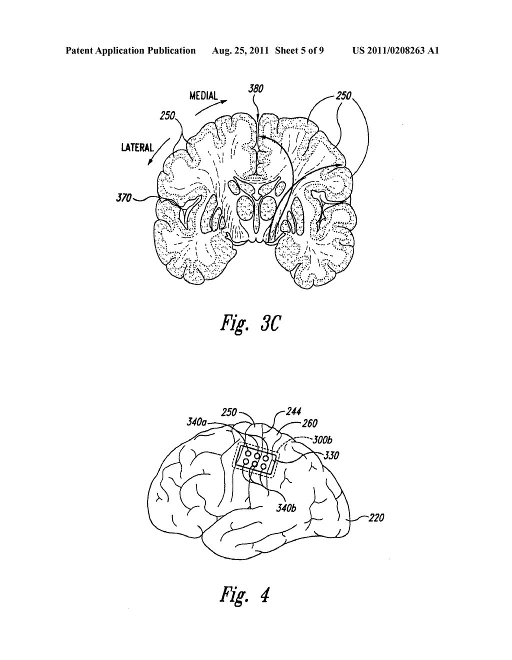 SYSTEM AND METHOD FOR TREATING PARKINSON'S DISEASE AND OTHER MOVEMENT     DISORDERS - diagram, schematic, and image 06