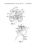 SYSTEM AND METHOD FOR TREATING PARKINSON S DISEASE AND OTHER MOVEMENT     DISORDERS diagram and image
